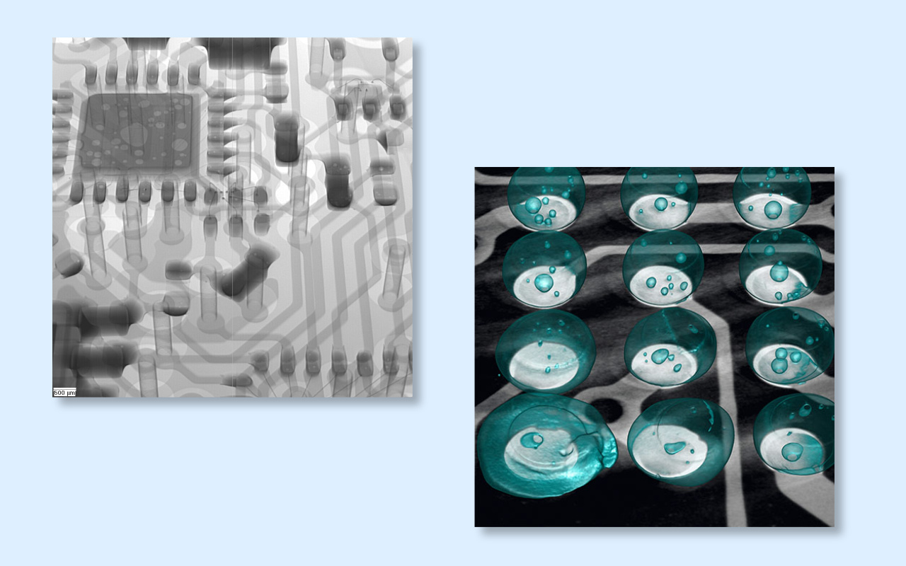 4. 2D vs 3D CT X-ray Which One Do You Really Need? 4. 2D vs 3D CT røntgen Hvilken en har du virkelig brug for?