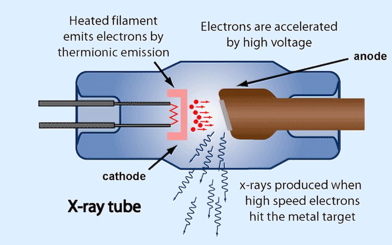 2. What X-ray Technology Actually Does 2. Hvad røntgenteknologi faktisk gør