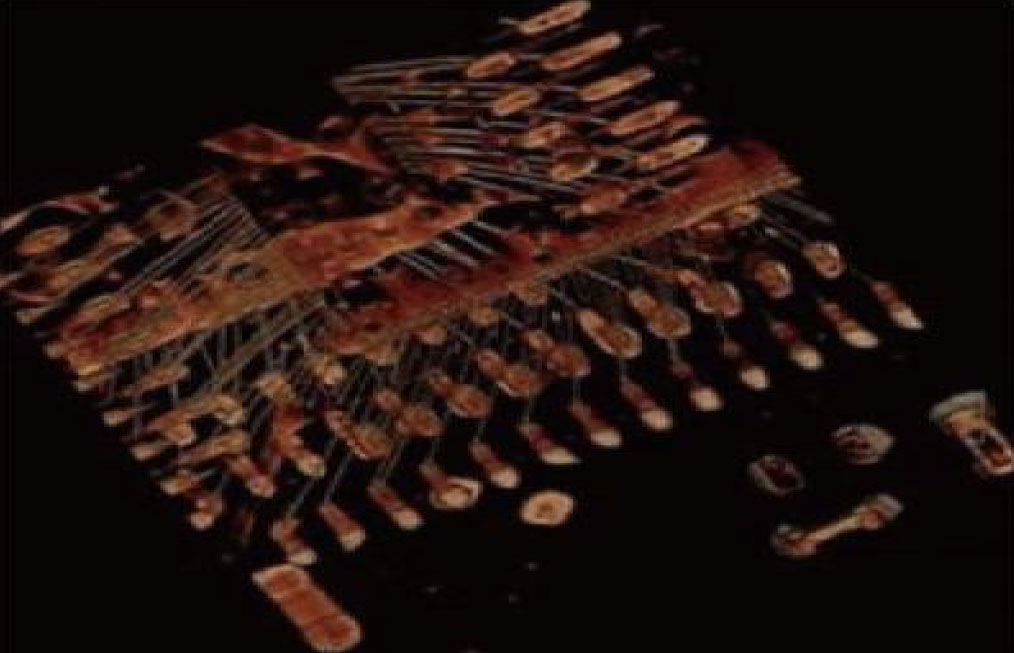 IC 3D CT-detektion